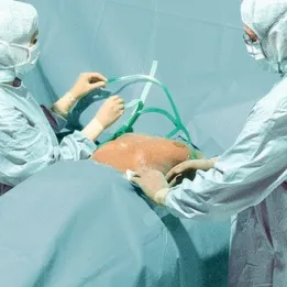 HARTMANN Foliodrape Protect Plus Angiographie-Set I ung à 5 Sets