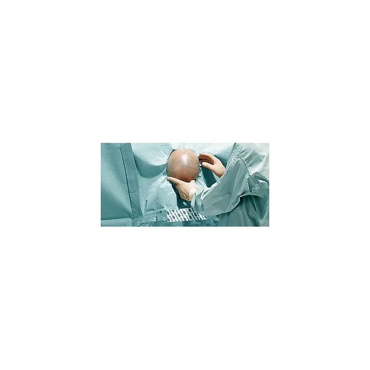 HARTMANN Foliodrape Protect Plus Angiographie-Set I ung à 5 Sets