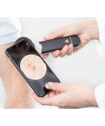 HEINE DELTA 30 Dermatoskop