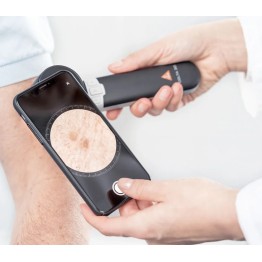 HEINE DELTA 30 Dermatoskop