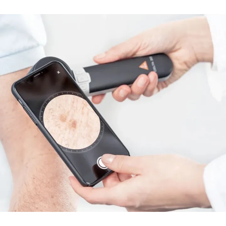 HEINE DELTA 30 LED Dermatoskop