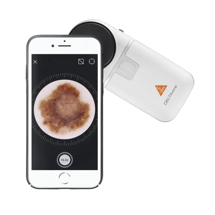 HEINE DELTAone LED Dermatoskop White Edition