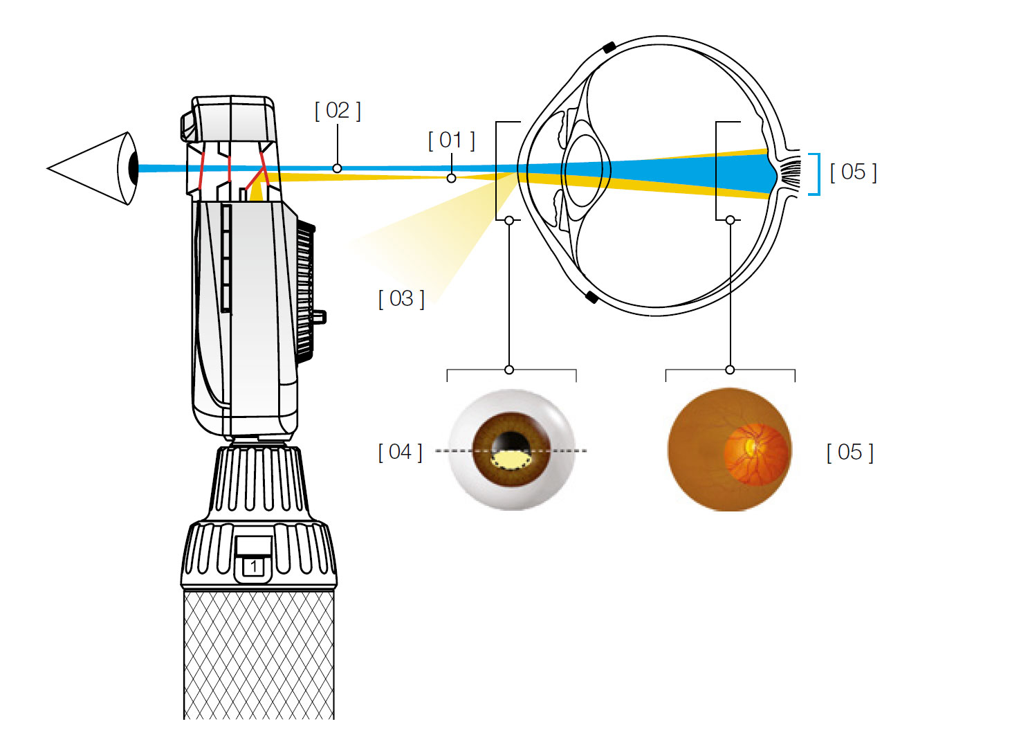 Asphärische Optische System (AOS) von HEINE