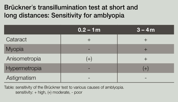 Brückner Tabelle für Abstände die Sensitivität