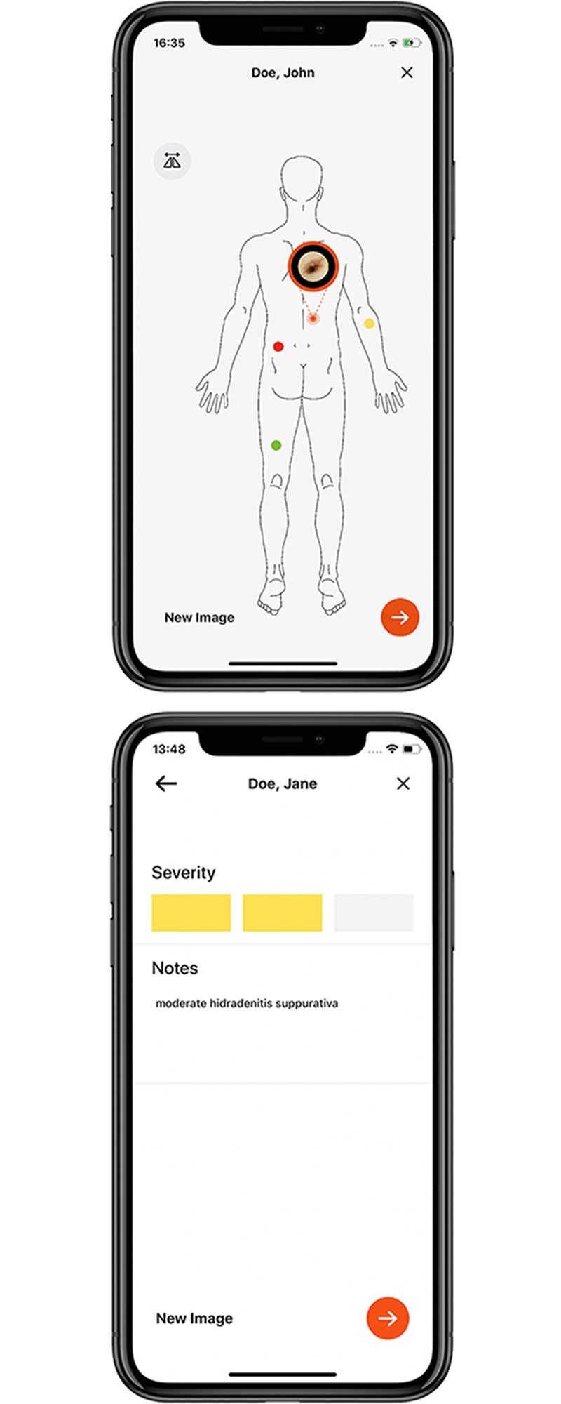 Workflow mit der HEINE DERM App Schritt-3