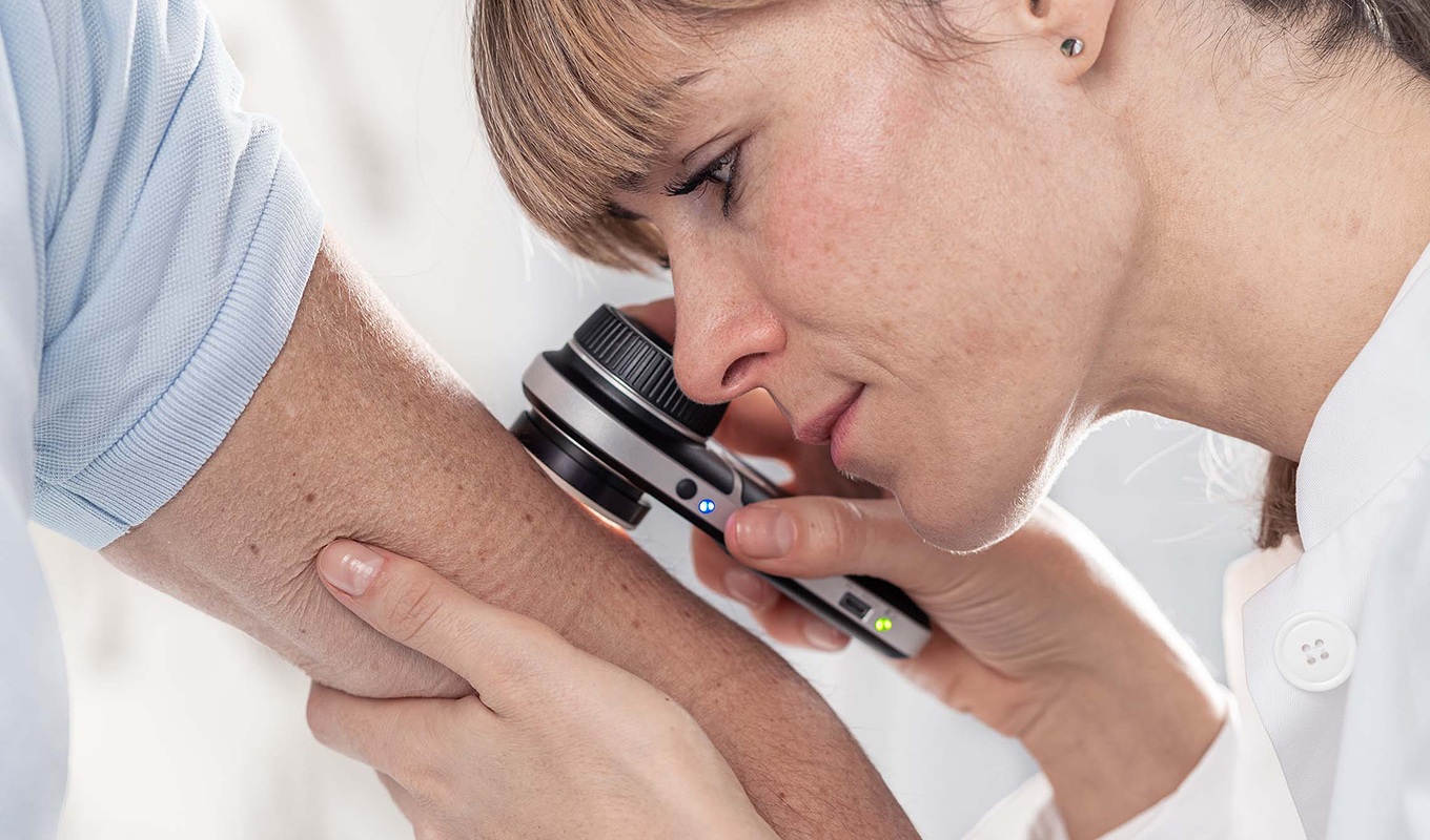 HEINE-Leitfaden-Hautkrebsscreening-Ugly_Duckling