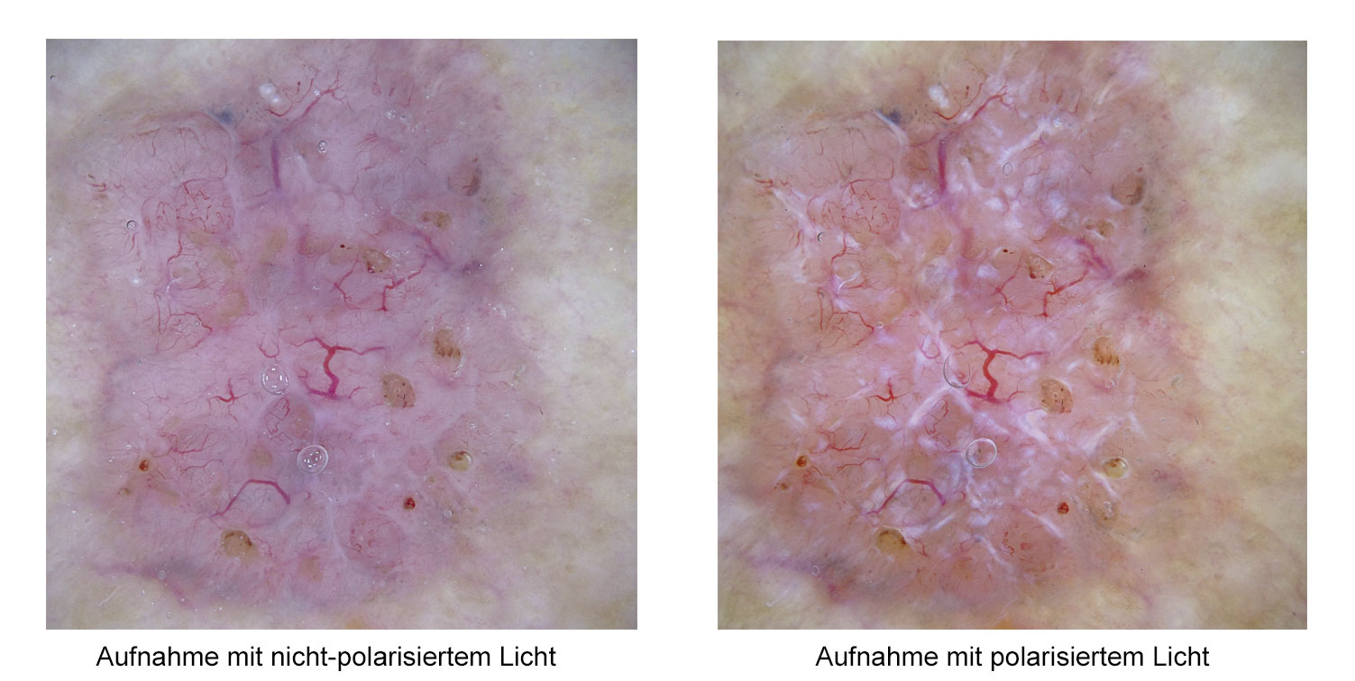 Aufnahme mit polarisiertem Licht