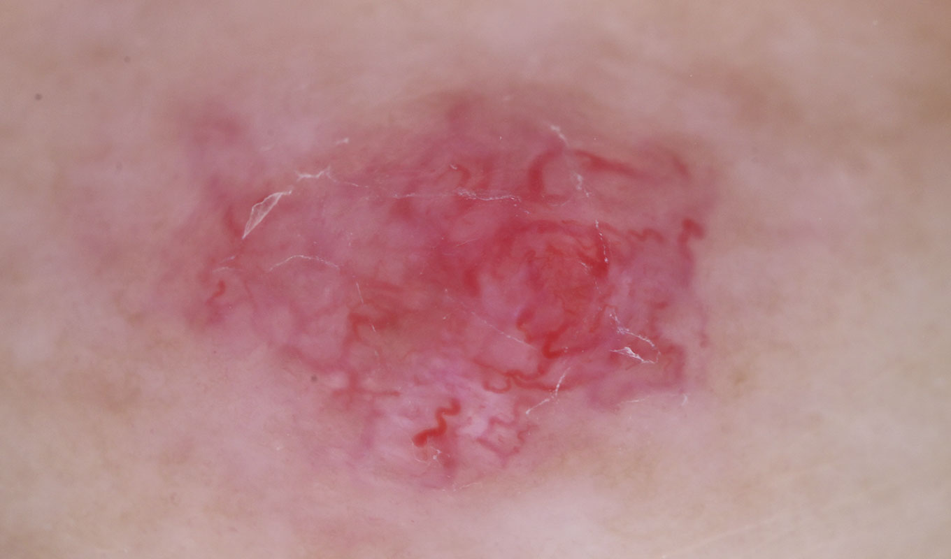 Aufnahme mit nicht-polarisiertem Licht Aufnahme mit nicht-polarisiertem Licht